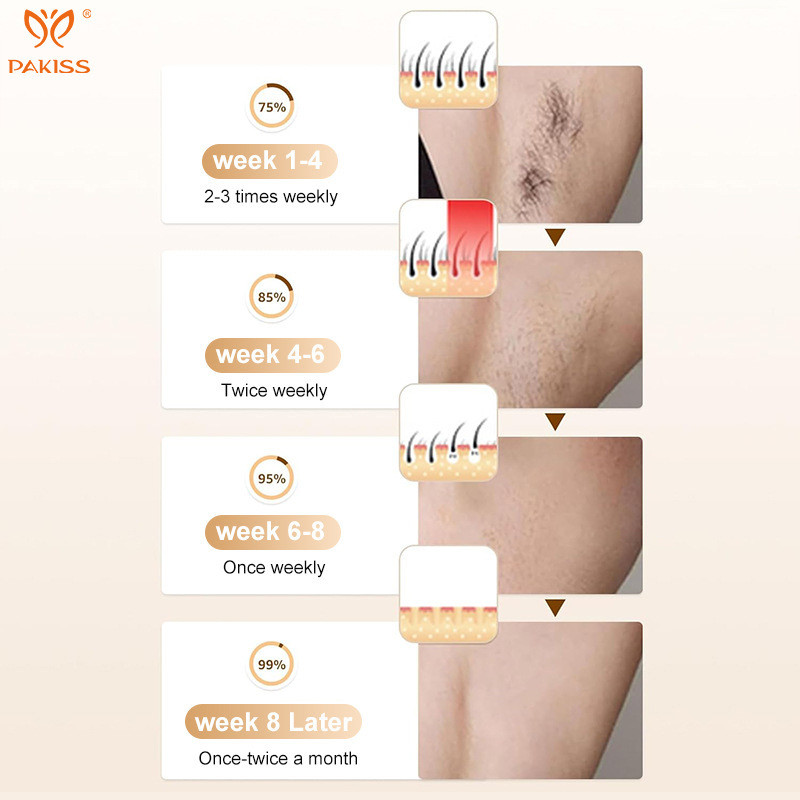 Electric Defamer with 21J Energy